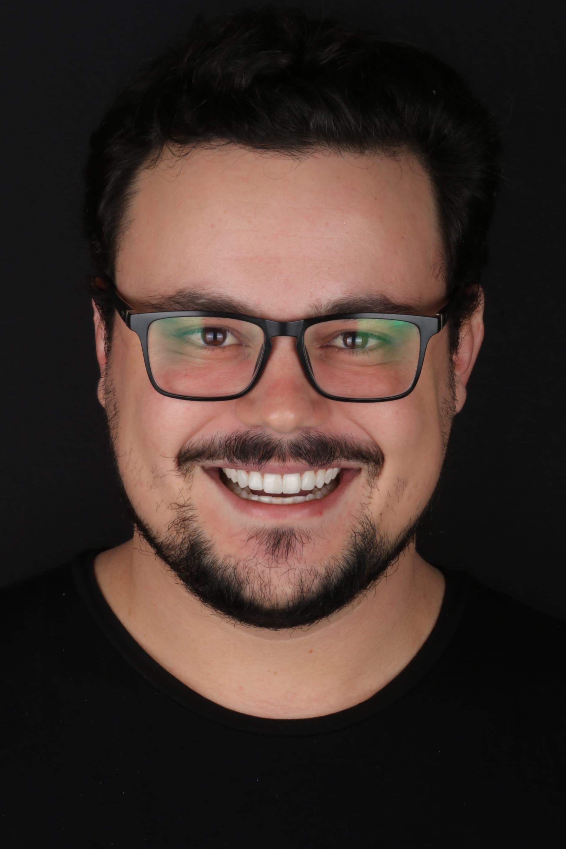 Sorriso após lentes, resultado natural