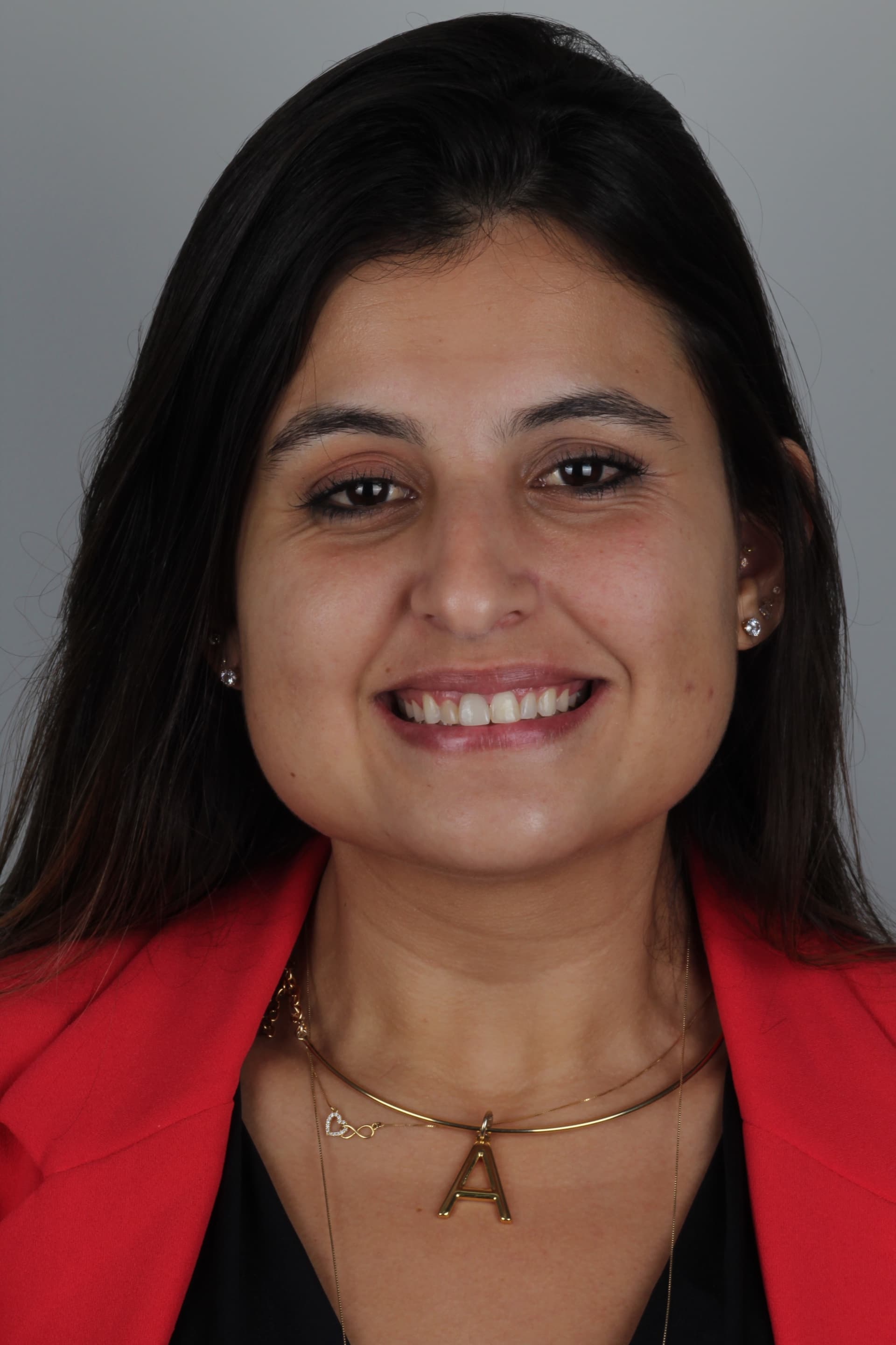 Sorriso antes do procedimento de lentes