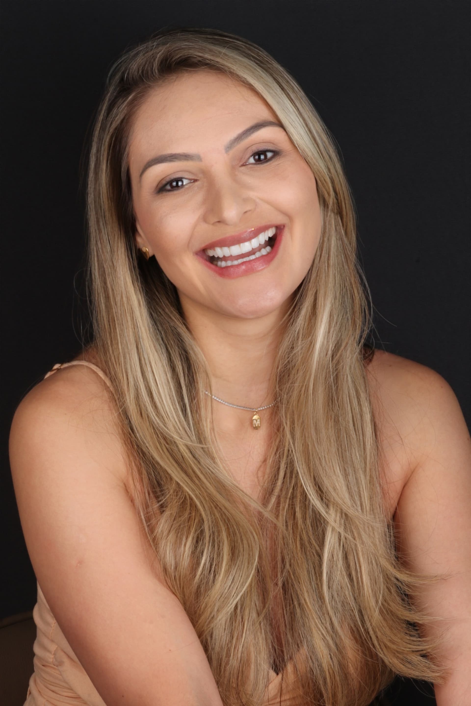 Sorriso após lentes, resultado natural