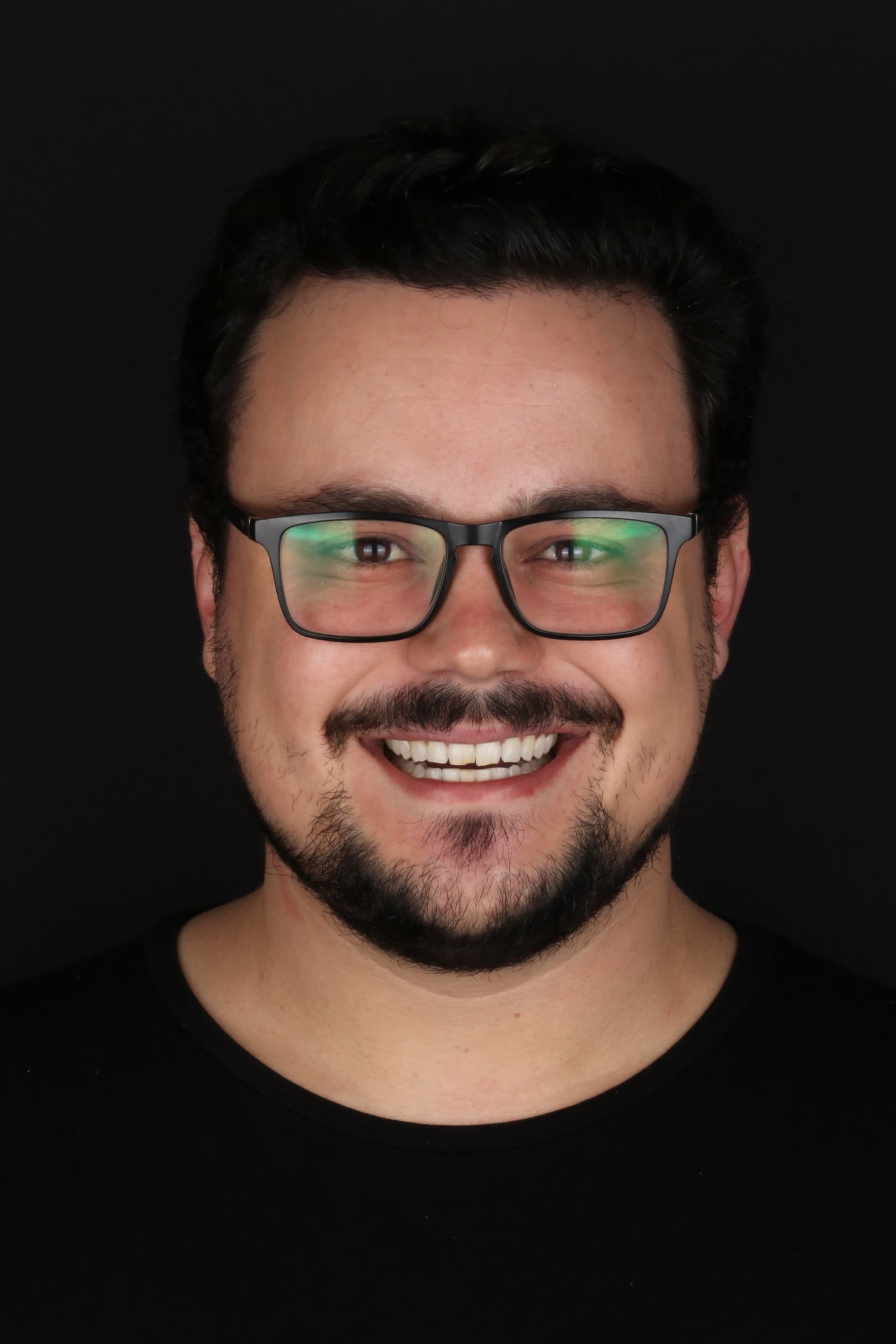 Sorriso antes do procedimento de lentes