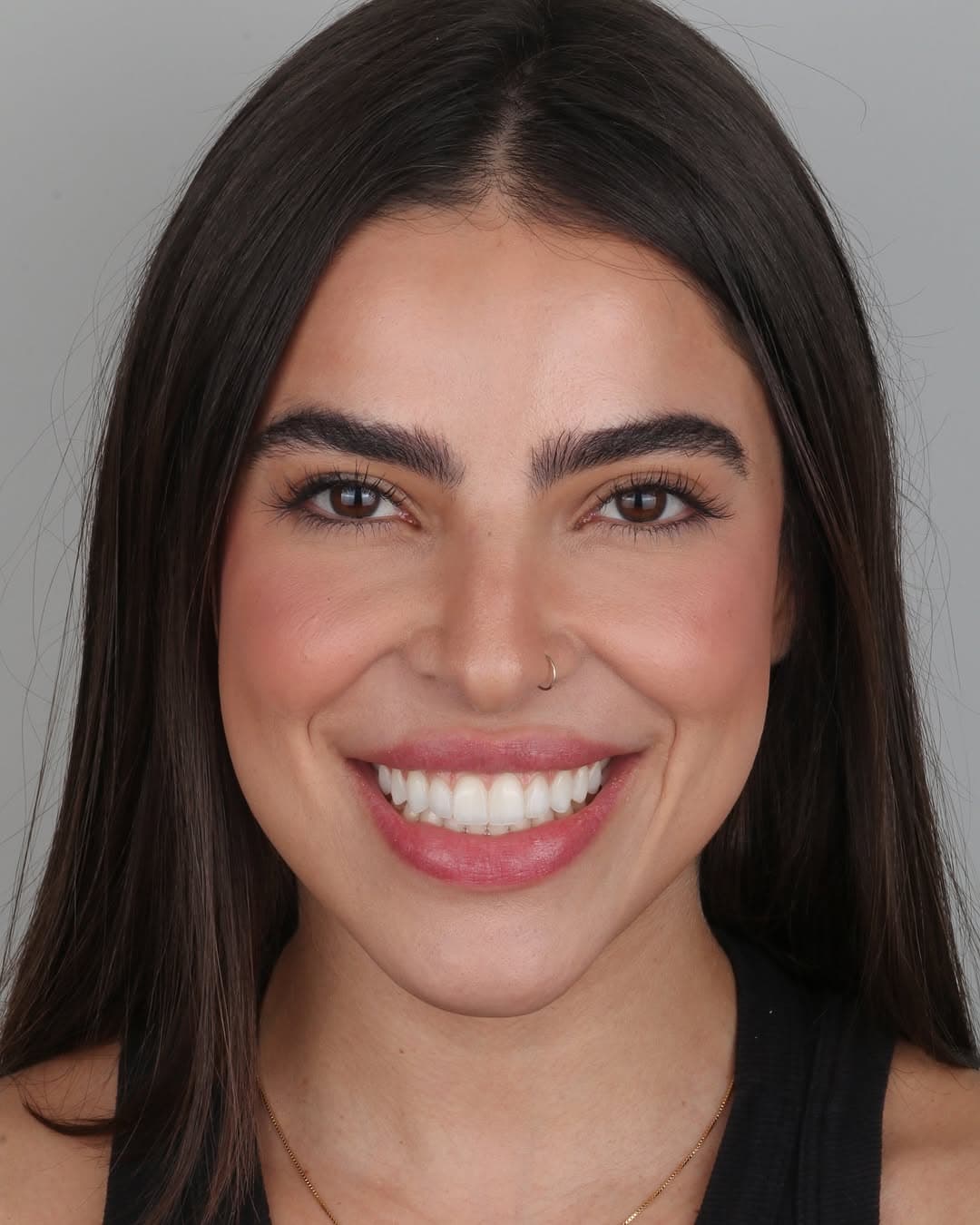 Trabalho realizado na Clínica Odontológica Unna 6