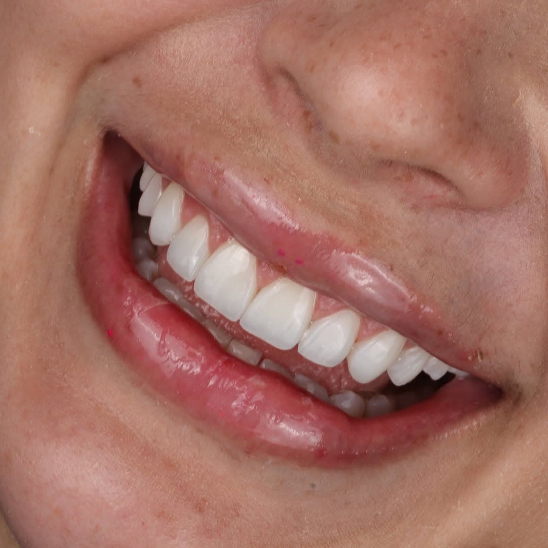 Trabalho realizado na Clínica Odontológica Unna 10