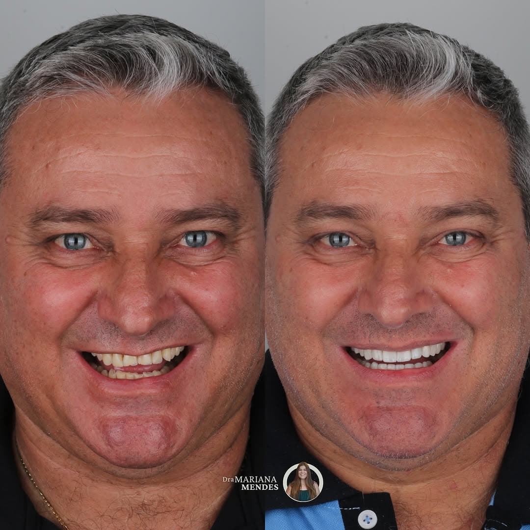 Trabalho realizado na Clínica Odontológica Unna 4