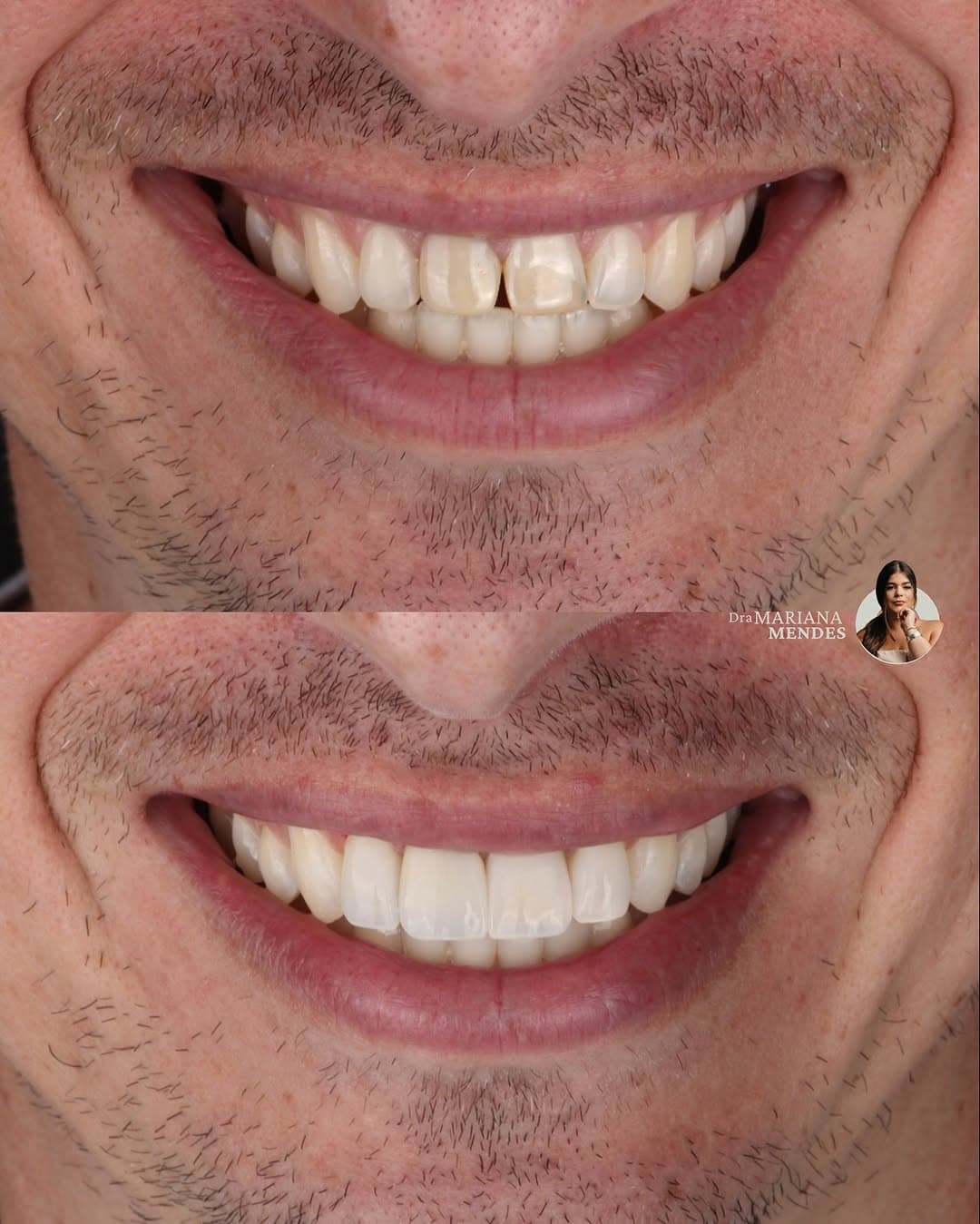 Trabalho realizado na Clínica Odontológica Unna 1