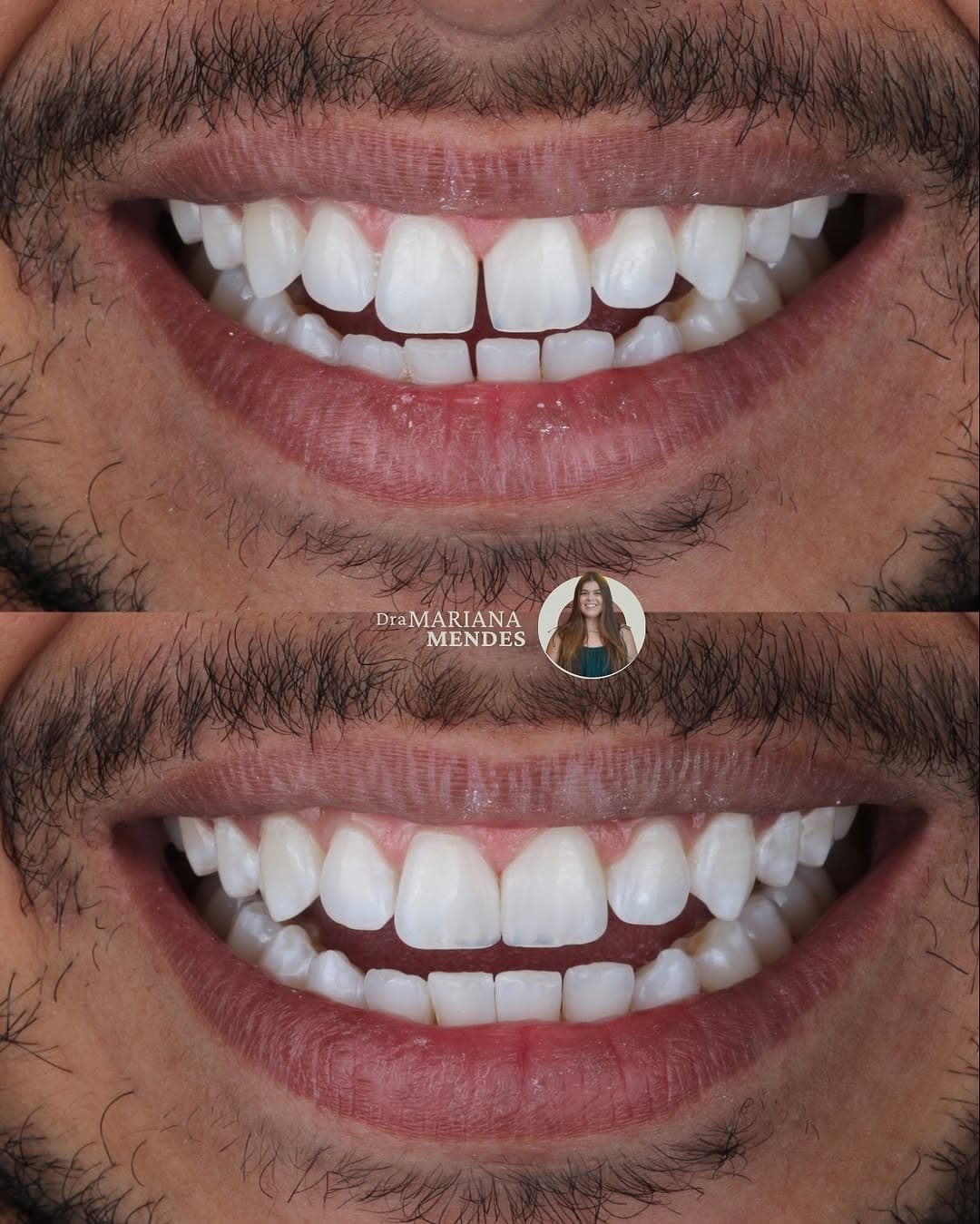 Trabalho realizado na Clínica Odontológica Unna 7