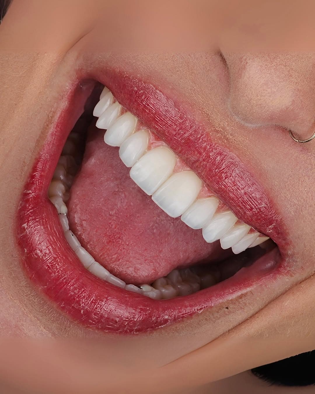 Trabalho realizado na Clínica Odontológica Unna 11