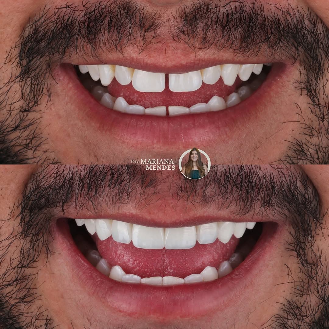 Trabalho realizado na Clínica Odontológica Unna 9