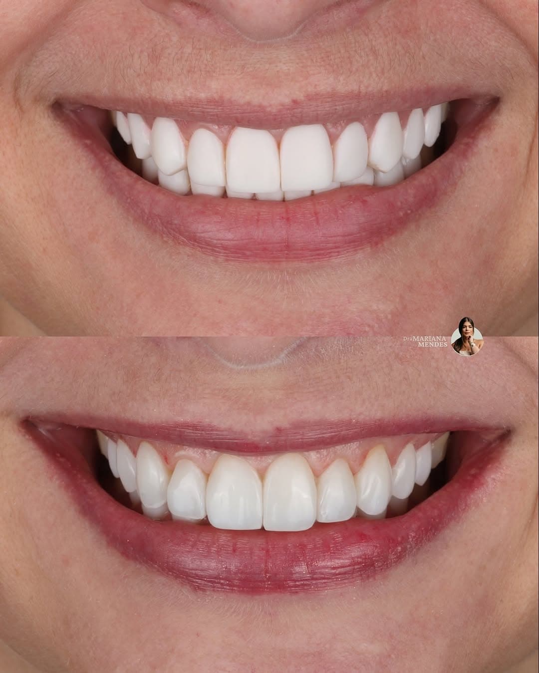 Trabalho realizado na Clínica Odontológica Unna 3